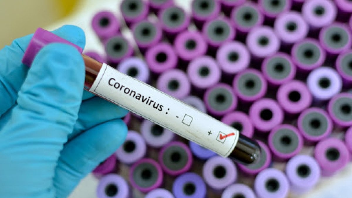 INTELLIGENZA ARTIFICIALE – Diagnosticare il coronavirus in 20 secondi